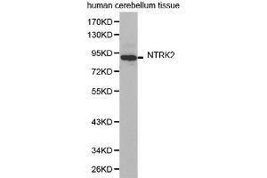 Western Blotting (WB) image for anti-Neurotrophic Tyrosine Kinase, Receptor, Type 2 (NTRK2) (AA 32-282) antibody (ABIN6219292) (TRKB 抗体  (AA 32-282))