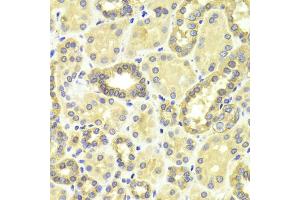 Immunohistochemistry of paraffin-embedded human kidney using MAP2K2 antibody. (MEK2 抗体)