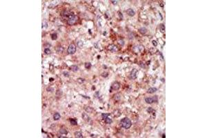 Image no. 2 for anti-Cyclin G Associated Kinase (GAK) (N-Term) antibody (ABIN360520) (GAK 抗体  (N-Term))