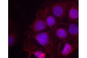 Immunofluorescence staining of methanol-fixed MCF cells using Phospho-ESR1-S118 antibody. (Estrogen Receptor alpha 抗体  (pSer118))