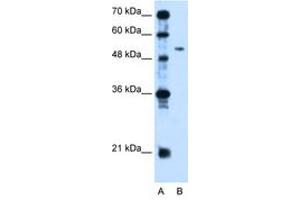 Image no. 1 for anti-Pregnancy Specific beta-1-Glycoprotein 1 (PSG1) (AA 96-145) antibody (ABIN204992) (PSG1 抗体  (AA 96-145))