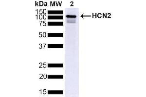 Western Blot analysis of Mouse Brain showing detection of ~95 kDa HCN2 protein using Mouse Anti-HCN2 Monoclonal Antibody, Clone S71 (ABIN2481391).