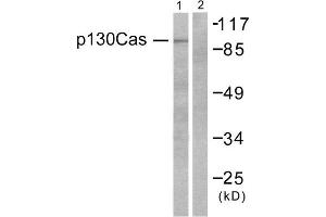 Western Blotting (WB) image for anti-Breast Cancer Anti-Estrogen Resistance 1 (BCAR1) (Tyr410) antibody (ABIN1847916) (BCAR1 抗体  (Tyr410))
