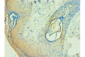 Immunohistochemistry of paraffin-embedded human skin tissue using ABIN7146501 at dilution of 1:100