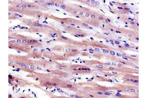 Immunohistochemistry of paraffin-embedded human heart tissue using ABIN7158887 at dilution of 1:100 (Macrophage Scavenger Receptor 1 抗体  (AA 271-446))