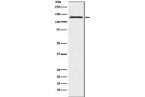 Western blot analysis of USP28 expression in A431 cell lysate.