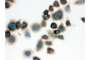Immunocytochemistry (ICC) image for anti-Chaperonin Containing TCP1, Subunit 4 (Delta) (CCT4) antibody (ABIN4952801)