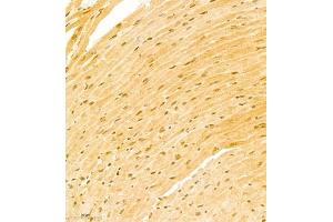 Immunohistochemistry of paraffin embedded mouse heart using ATF7 (ABIN7072916) at dilution of 1:800 (300x lens) (ATF7 抗体)