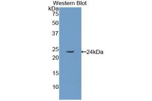 Detection of Recombinant RBP4, Human using Polyclonal Antibody to Retinol Binding Protein 4 (RBP4) (RBP4 抗体)