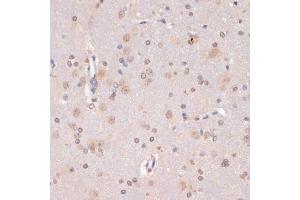 Immunohistochemistry (IHC) image for anti-P53-Induced Death Domain Protein (PIDD) (AA 1-85) antibody (ABIN1680710)