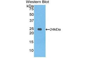 Western Blotting (WB) image for anti-Spondin 1 (SPON1) (AA 608-802) antibody (ABIN1860615)