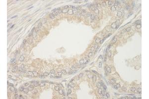 Immunohistochemistry (IHC) image for anti-BCL2-Associated Agonist of Cell Death (BAD) (AA 1-50) antibody (ABIN7448932)
