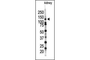 Western blot analysis of SENP7 polyclonal antibody (ABIN388053 and ABIN2845652) in mouse kidney tissue lysate (35 μg/lane). (SENP7 抗体  (C-Term))
