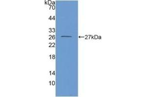 Detection of Recombinant GDH, Mouse using Polyclonal Antibody to Glutamate Dehydrogenase 1 (GLUD1) (GLUD1 抗体  (AA 65-273))