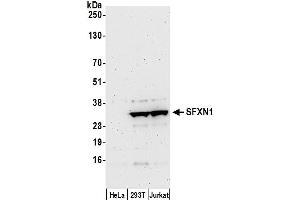 anti-Sideroflexin 1 (SFXN1) (AA 1-50) antibody