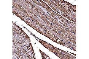 IHC analysis of DOK7 using anti-DOK7 antibody (ABIN6719428).