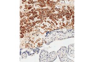 Immunohistochemical analysis of paraffin-embedded Human placenta tissue using (ABIN652888 and ABIN2842575) performed on the Leica® BOND RXm. (HLAG 抗体  (AA 62-89))