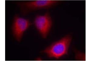 Image no. 2 for anti-Protein Kinase C, theta (PRKCQ) (AA 674-678) antibody (ABIN197566) (PKC theta 抗体  (AA 674-678))