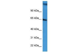 WB Suggested Anti-BCAM Antibody Titration: 0. (BCAM 抗体  (C-Term))