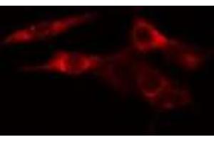 ABIN6277566 staining HeLa cells by IF/ICC. (EEF2K 抗体  (Internal Region))