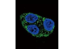 Confocal immunofluorescent analysis of Tyrosinase Antibody (C-term) Cat. (TYR 抗体  (C-Term))