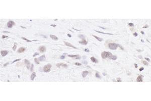 Immunohistochemistry (IHC) image for anti-Polymerase (RNA) III (DNA Directed) Polypeptide B (POLR3B) (AA 1083-1133) antibody (ABIN7453642)