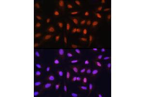 Immunofluorescence analysis of U-2 OS cells using GTF2H1 Rabbit pAb (ABIN6131728, ABIN6141498, ABIN6141499 and ABIN6222557) at dilution of 1:100 (40x lens). (GTF2H1 抗体  (AA 1-425))