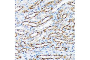 Immunohistochemistry of paraffin-embedded mouse kidney using p70 S6 Kinase 2 Rabbit mAb (ABIN7270034) at dilution of 1:100 (40x lens).