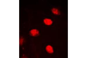 Immunofluorescent analysis of NPAS4 staining in HEK293T cells. (NPAS4 抗体  (C-Term))