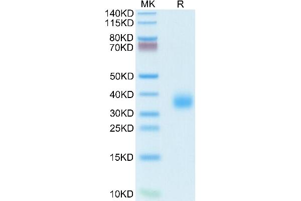 ROR1 Protein (AA 39-151) (His tag)