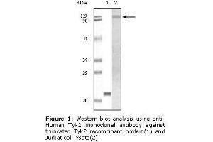 Image no. 1 for anti-Tyrosine Kinase 2 (TYK2) antibody (ABIN232114) (TYK2 抗体)