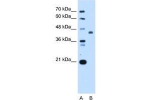 Western Blotting (WB) image for anti-ST3 beta-Galactoside alpha-2,3-Sialyltransferase 4 (ST3GAL4) antibody (ABIN2462999) (ST3GAL4 抗体)