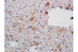 Immunohistochemistry (Paraffin-embedded Sections) (IHC (p)) image for anti-Solute Carrier Family 18 (Vesicular Acetylcholine), Member 3 (SLC18A3) (AA 201-300) antibody (ABIN735113)