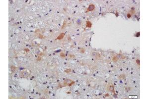 Formalin-fixed and paraffin embedded rat brain labeled with Rabbit Anti-VAT Polyclonal Antibody, Unconjugated (ABIN735113) at 1:200 followed by conjugation to the secondary antibody and DAB staining (SLC18A3 抗体  (AA 201-300))