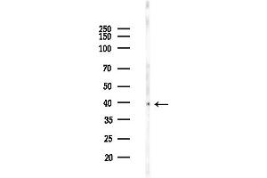 anti-Tropomodulin 4 (TMOD4) (Internal Region) antibody