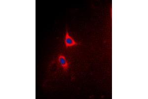 Immunofluorescent analysis of BCLX (pT47) staining in Hela cells. (BCL2L1 抗体  (pSer47))