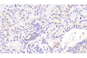 Detection of ITGa2 in Human Kidney Tissue using Polyclonal Antibody to Integrin Alpha 2 (ITGa2) (ITGA2 抗体  (AA 170-361))