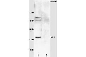 L1 rat brain lysates L2 rat kidney lysates probed with Anti IL-2R gamma/CD132 Polyclonal Antibody, Unconjugated (ABIN685432) at 1:200 overnight at 4 °C. (GADD45A 抗体  (AA 65-165))