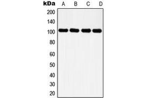 Western blot analysis of Histone Deacetylase 7 expression in HeLa (A), NIH3T3 (B), PC12 (C), rat kidney (D) whole cell lysates. (HDAC7 抗体  (C-Term))