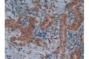 Used in DAB staining on fromalin fixed paraffin-embedded Liver tissue (CD40 Ligand 抗体  (AA 180-261))