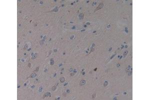 Used in DAB staining on fromalin fixed paraffin- embedded brain tissue (SMS 抗体  (AA 2-366))