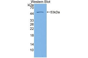 Western blot analysis of the recombinant protein. (RS1 抗体  (AA 24-224))