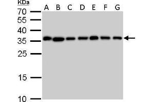 WB Image PPA1 antibody detects PPA1 protein by Western blot analysis. (Pyrophosphatase (Inorganic) 1 (PPA1) 抗体)