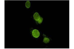 Image no. 1 for anti-Spectrin Repeat Containing, Nuclear Envelope 2 (SYNE2) antibody (ABIN1042629) (SYNE2 抗体)