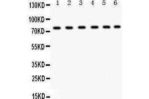 Western Blotting (WB) image for anti-Transient Receptor Potential Cation Channel, Subfamily V, Member 5 (TRPV5) (AA 580-610), (C-Term) antibody (ABIN3043496)