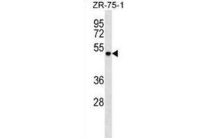 Western Blotting (WB) image for anti-DEAD (Asp-Glu-Ala-Asp) Box Polypeptide 6 (DDX6) antibody (ABIN2999135) (DDX6 抗体)