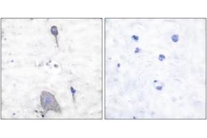 Immunohistochemistry analysis of paraffin-embedded human brain tissue, using Sirp alpha1 Antibody. (SIRPA 抗体  (AA 451-500))