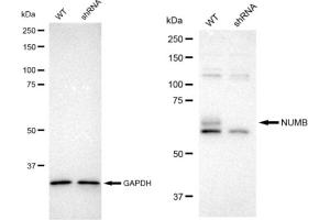Western blotting analysis using NUMB antibody (ABIN7799693). (Recombinant NUMB 抗体)