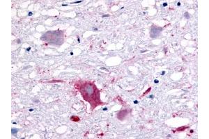 Immunohistochemical staining of Brain (Neurons and glia) using anti- GPR32 antibody ABIN122142 (GPR32 抗体)