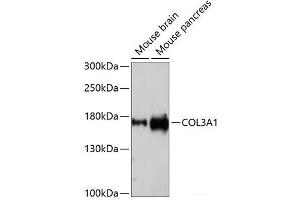 Western Blotting (WB) image for anti-Collagen, Type III, alpha 1 (COL3A1) antibody (ABIN7260861)